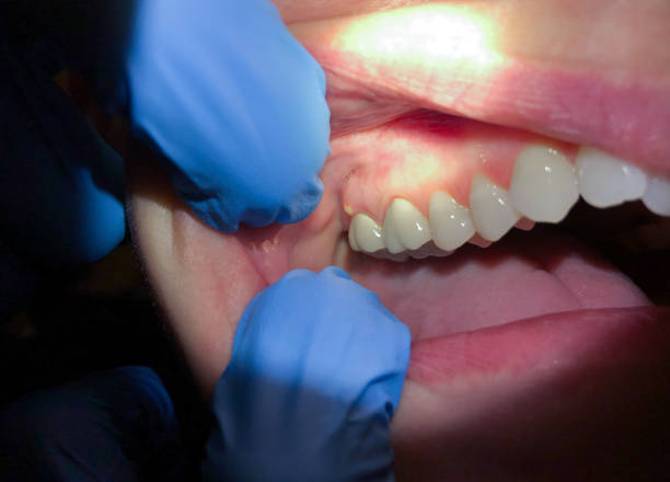 Best Mobile Emergency Dentist in Cleveland, TN